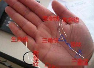 三角纹位于生命线上,这种情形分为两种,一种是三角纹压在生命线上