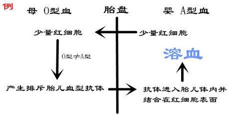侯佩岑因宝宝患abo新生儿溶血症提前剖腹,这种病其实离你很近?
