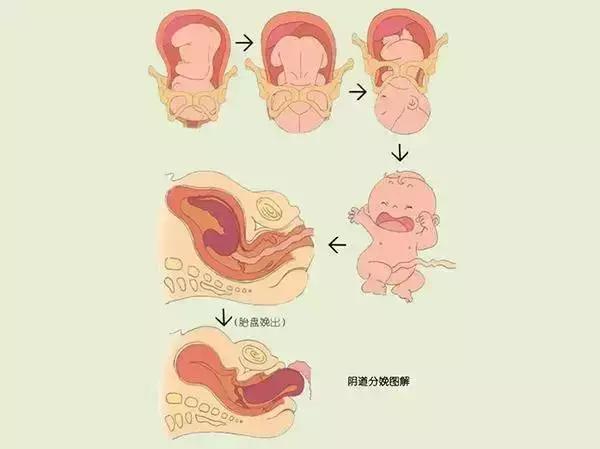 胎儿出生全过程图解,原来宝宝是旋转着通过产道的!