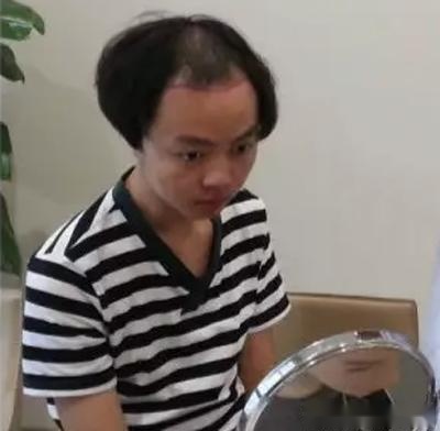 秃顶的他,头发轻松长出来了,拉仇恨!