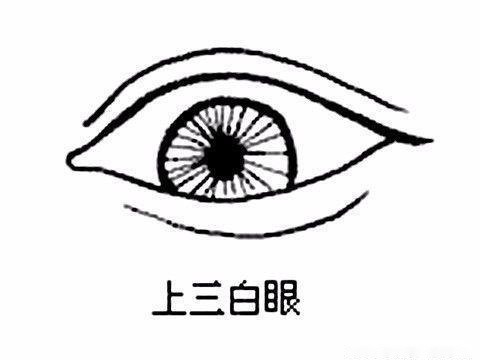 教你如何从眼睛了解一个人 传说中的"三白眼"到底长什么样?